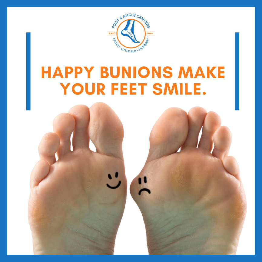 How Do Bunions Develop? - Foot & Ankle Centers of Frisco and Plano