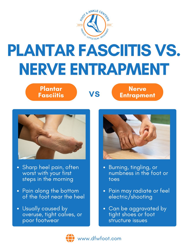 Plantar Fasciitis vs Nerve Entrapment | Foot & Ankle Centers