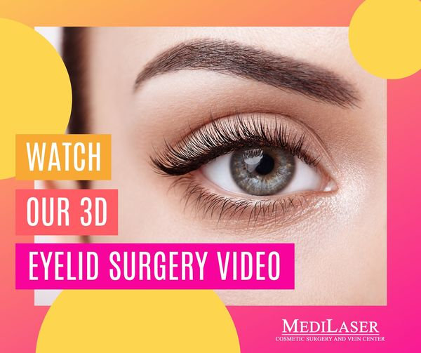 Eyelid surgery store video